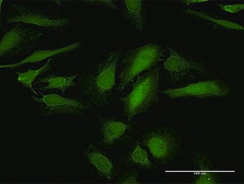 Anti-LGALS1 antibody produced in rabbit purified immunoglobulin, buffered aqueous solution