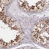 Anti-PBK antibody produced in rabbit Prestige Antibodies&#174; Powered by Atlas Antibodies, affinity isolated antibody