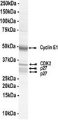p27 Protein complex, activated, 10 &#181;g Activated complex of three (3) full length, recombinant human proteins: p27, Cyclin E1, &amp; CDK2. Phosphorylated in vitro using CDK2/Cyclin E1. For use in Enzyme Assays. Behaves as a substrate in ubiquitin assays.