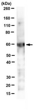 Anti-Chlamydial HSP60 Antibody, clone A57-B9 clone A57-B9, from mouse