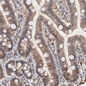 Anti-CASP3 antibody produced in rabbit Prestige Antibodies&#174; Powered by Atlas Antibodies, affinity isolated antibody, buffered aqueous glycerol solution