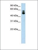 Anti-HDAC9 antibody produced in rabbit IgG fraction of antiserum