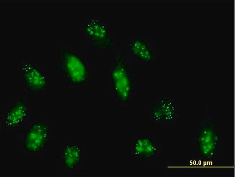 Anti-CENPB antibody produced in mouse purified immunoglobulin, buffered aqueous solution