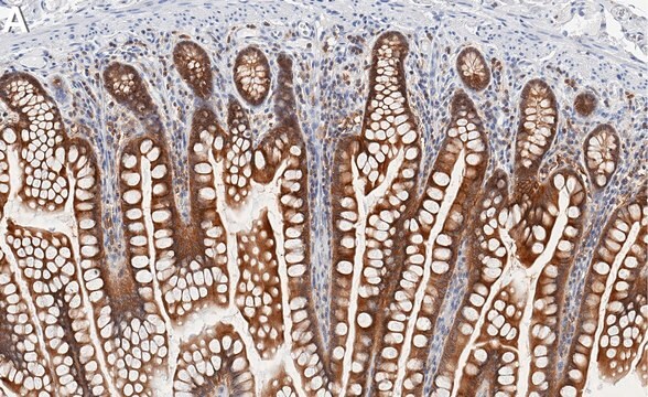 Anti-RSK-1 Antibody, clone 1C18 ZooMAb&#174; Rabbit Monoclonal recombinant, expressed in HEK 293 cells