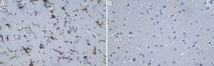 Anti-P2RY12 Antibody, clone 2C12 ZooMAb&#174; Rabbit Monoclonal recombinant, expressed in HEK 293 cells