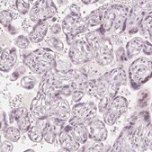 Anti-SFRP4 antibody produced in rabbit Prestige Antibodies&#174; Powered by Atlas Antibodies, affinity isolated antibody, buffered aqueous glycerol solution