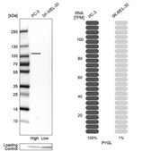Anti-PYGL antibody produced in rabbit Prestige Antibodies&#174; Powered by Atlas Antibodies, affinity isolated antibody, buffered aqueous glycerol solution