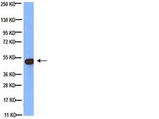 Anti-Tubulin Antibody, beta, clone KMX-1 clone KMX-1, Chemicon&#174;, from mouse