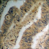 Anti-phospho-PKC &#945; (pTyr658) antibody produced in rabbit affinity isolated antibody