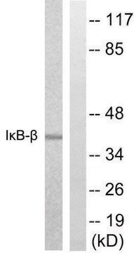 Anti-I&#954;B-&#946; antibody produced in rabbit affinity isolated antibody