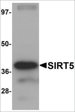 Anti-SIRT5 antibody produced in chicken affinity isolated antibody, buffered aqueous solution