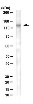 Anti-Desmoglein 3 Antibody, clone 5H10 clone 5H10, from mouse