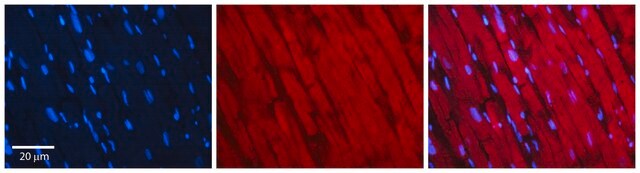 Anti-BAT3 (C-terminal) antibody produced in rabbit affinity isolated antibody