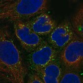 Anti-VTN antibody produced in rabbit Prestige Antibodies&#174; Powered by Atlas Antibodies, affinity isolated antibody, buffered aqueous glycerol solution