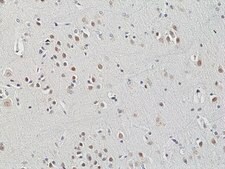 Anti-HDAC3 Rabbit Monoclonal Antibody clone RM439, affinity purified immunoglobulin