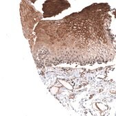 Anti-CACNA1H antibody produced in rabbit Prestige Antibodies&#174; Powered by Atlas Antibodies, affinity isolated antibody, buffered aqueous glycerol solution