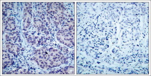 Anti-HDAC2 (Ab-394) antibody produced in rabbit affinity isolated antibody