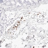 Anti-CAMP antibody produced in rabbit Prestige Antibodies&#174; Powered by Atlas Antibodies, affinity isolated antibody, buffered aqueous glycerol solution