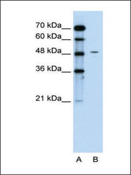 Anti-CHGA affinity isolated antibody