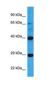Anti-ARG2 antibody produced in rabbit affinity isolated antibody