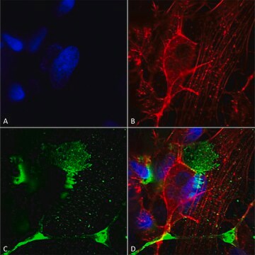 Monoclonal Anti-Tarp Gamma2/4/8 (Stargazin) - Hrp antibody produced in mouse clone S245-36, purified immunoglobulin