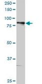 Anti-ALOX5 antibody produced in rabbit purified immunoglobulin, buffered aqueous solution
