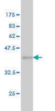 ANTI-FHIT antibody produced in mouse clone 1C5, purified immunoglobulin, buffered aqueous solution