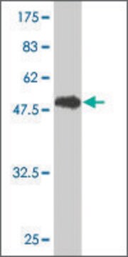 Monoclonal Anti-GSTT1 antibody produced in mouse clone 2E10-1B2, purified immunoglobulin, buffered aqueous solution