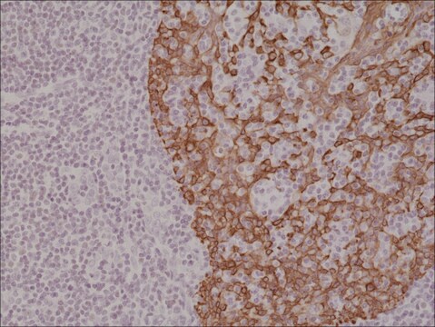 Anti-CK-14 (Cytokeratin-14) antibody, Rabbit monoclonal recombinant, expressed in HEK 293 cells, clone RM328, purified immunoglobulin