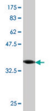 Monoclonal Anti-ROPN1 antibody produced in mouse clone 1B10, purified immunoglobulin, buffered aqueous solution