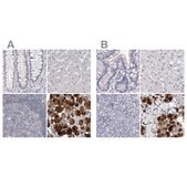 Anti-CA6 antibody produced in rabbit Prestige Antibodies&#174; Powered by Atlas Antibodies, affinity isolated antibody, buffered aqueous glycerol solution, ab2