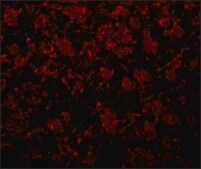 Anti-GOLPH2 antibody produced in rabbit affinity isolated antibody, buffered aqueous solution
