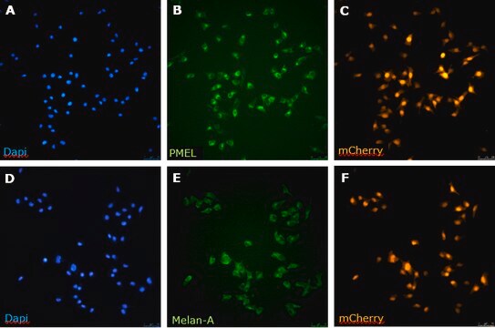 BT-RMS Brain-tropic RET Melanoma-sorted Mouse Cell Line