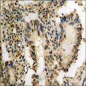 Anti-phospho-p38 MAPK (pTyr182) antibody produced in rabbit affinity isolated antibody