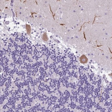 Anti-PAK3 antibody produced in rabbit Prestige Antibodies&#174; Powered by Atlas Antibodies, affinity isolated antibody, buffered aqueous glycerol solution