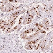 Monoclonal Anti-ANLN antibody produced in mouse Prestige Antibodies&#174; Powered by Atlas Antibodies, clone CL0303, purified immunoglobulin, buffered aqueous glycerol solution
