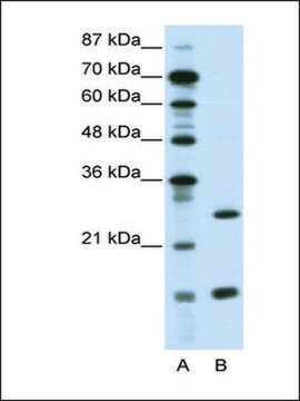 Anti-CEBPG antibody produced in rabbit affinity isolated antibody