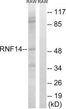 Anti-RNF14 antibody produced in rabbit affinity isolated antibody