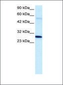 Anti-PARP1 antibody produced in rabbit IgG fraction of antiserum