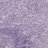 Anti-CYP11B1 antibody produced in rabbit Prestige Antibodies&#174; Powered by Atlas Antibodies, affinity isolated antibody, buffered aqueous glycerol solution