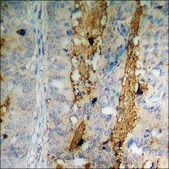 Anti-phospho-FGFR1 (pTyr766) antibody produced in rabbit affinity isolated antibody