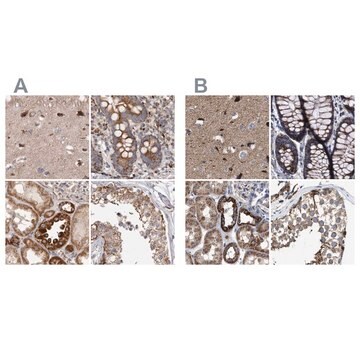 Anti-MECR antibody produced in rabbit Prestige Antibodies&#174; Powered by Atlas Antibodies, affinity isolated antibody, buffered aqueous glycerol solution