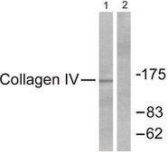 Anti-Collagen IV antibody produced in rabbit affinity isolated antibody