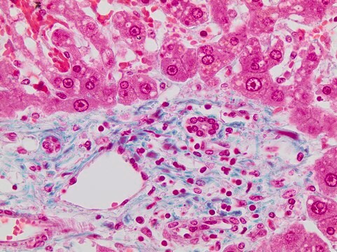 Trichrome Stain LG Solution