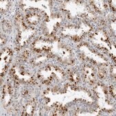 Anti-CIART antibody produced in rabbit Prestige Antibodies&#174; Powered by Atlas Antibodies, affinity isolated antibody, buffered aqueous glycerol solution
