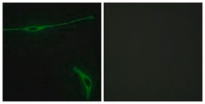Anti-LAMA2 antibody produced in rabbit affinity isolated antibody