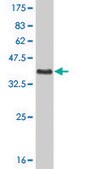 Monoclonal Anti-PGR antibody produced in mouse clone 5D10, purified immunoglobulin, buffered aqueous solution