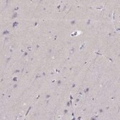 Anti-P2RY10 antibody produced in rabbit Prestige Antibodies&#174; Powered by Atlas Antibodies, affinity isolated antibody