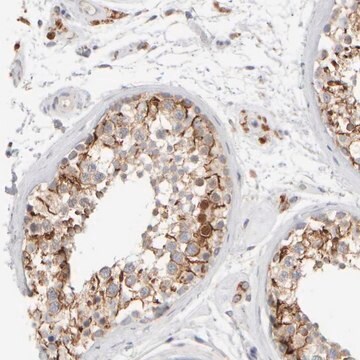 Anti-ZNF112 antibody produced in rabbit Prestige Antibodies&#174; Powered by Atlas Antibodies, affinity isolated antibody, buffered aqueous glycerol solution