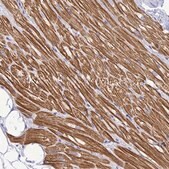 Anti-TNNI3 antibody produced in rabbit Prestige Antibodies&#174; Powered by Atlas Antibodies, affinity isolated antibody, buffered aqueous glycerol solution